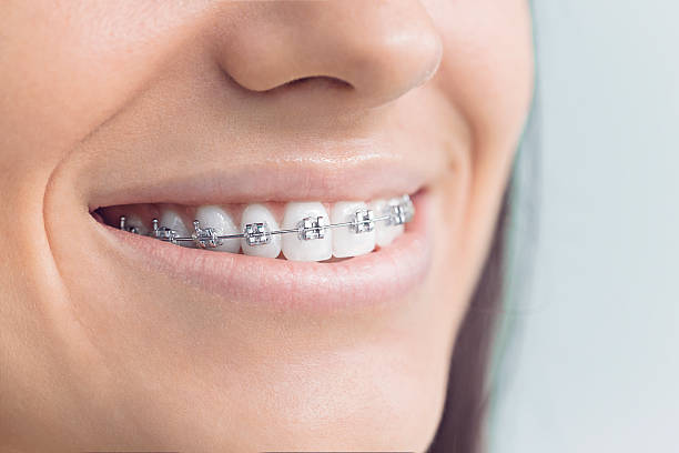 Best Wisdom Tooth Removal  in Seneca, MO